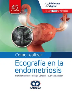 Portada de Cómo Realizar Ecografía en la Endometriosis