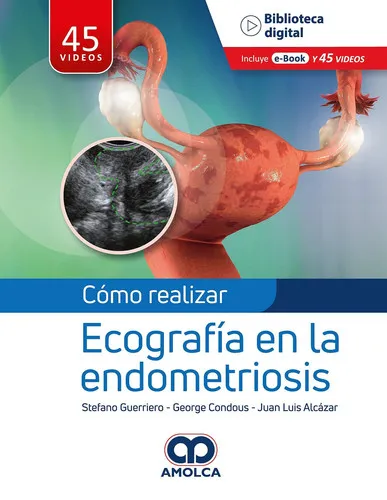 Portada de Cómo Realizar Ecografía en la Endometriosis