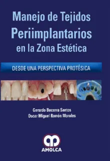 Portada de Manejo de tejidos perimplantarios en la zona estética desde una perspectiva protéstica