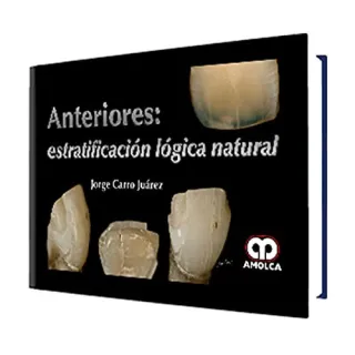 Portada de Anteriores: Estratificacion Lógica Natural (Spanish Edition)
