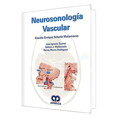Portada de Neurosonología Vascular
