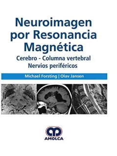 Portada de Neuroimagen por Resonancia Magnética. Cerebro - Columna Vertebral Nervios periféricos