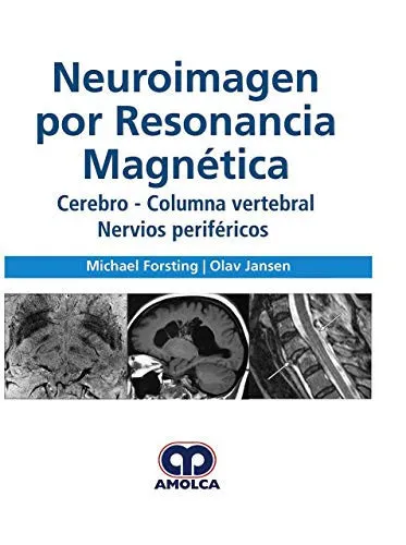 Portada de Neuroimagen por Resonancia Magnética. Cerebro - Columna Vertebral Nervios periféricos