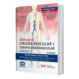 Portada de RUTHERFORD Cirugía Vascular y Terapia Endovascular: Venoso + E-Book y 3 Videos