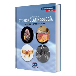 Portada de Imágenes en otorrinolaringología