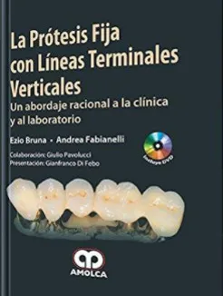 Portada de La prótesis fija con líneas terminales verticales un abordaje racional a la clínica y al laboratorio
