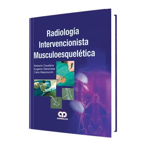 Portada de Radiología intervencionista musculoesquelética