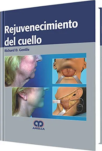 Portada de Rejuvenecimiento del cuello (Spanish Edition)