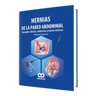 Portada de Hernias de la pared abdominal conceptos clásicos, evidencias y nuevas técnicas