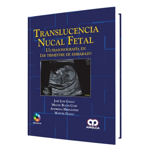 Portada de Translucencia Nucal Fetal. Ultrasonografía en 1er Trimestre de Emb.
