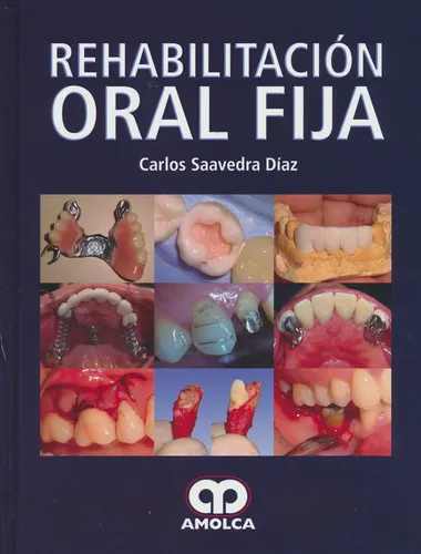 Portada de Rehabilitación oral fija