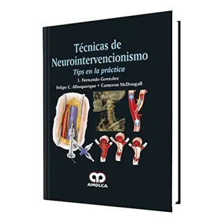 Portada de Técnicas de neurointervencionismo: tips en la práctica