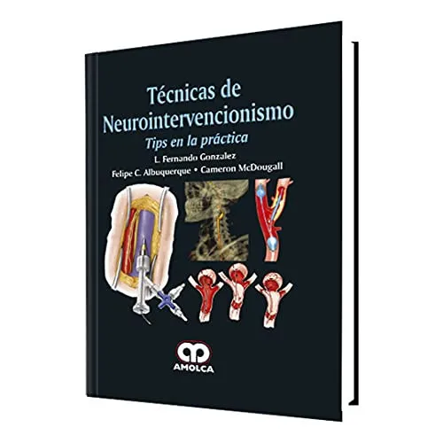 Portada de Técnicas de neurointervencionismo: tips en la práctica