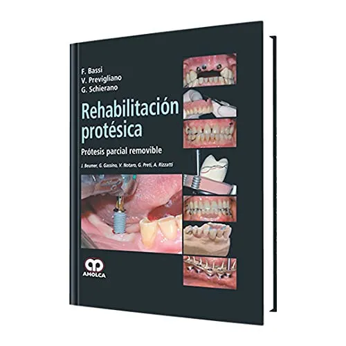 Portada de Rehabilitación protésica prótesis parcial removible