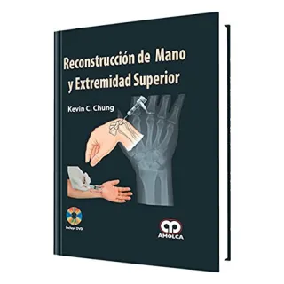 Portada de Reconstruccin̤ de mano y extremidad superior
