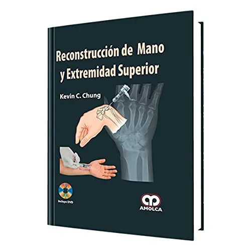 Portada de Reconstruccin̤ de mano y extremidad superior