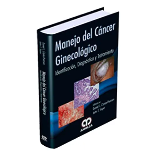 Portada de Manejo del cáncer ginecológico identificación, diagnóstico y tratamiento