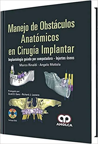 Portada de Manejo de obstáculos anatómicos en cirugía implantar implantología guiada por computadora - injertos óseos