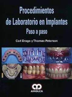 Portada de Procedimientos de laboratorio en implantes. Paso a paso (Spanish Edition)