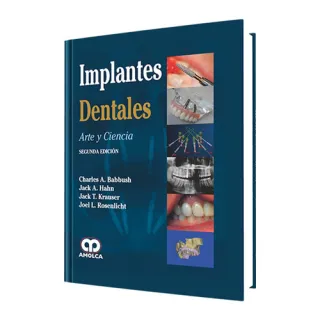 Portada de Implantes dentales arte y ciencia