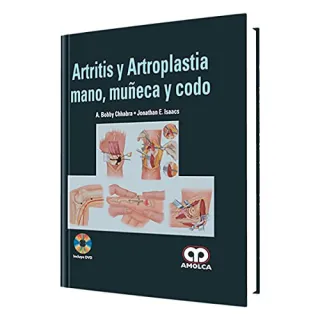 Portada de Artritis y Artrosplastia Mano, Muñeca y Codo
