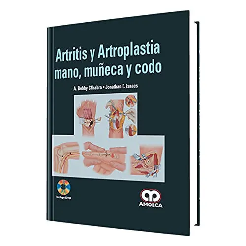 Portada de Artritis y Artrosplastia Mano, Muñeca y Codo