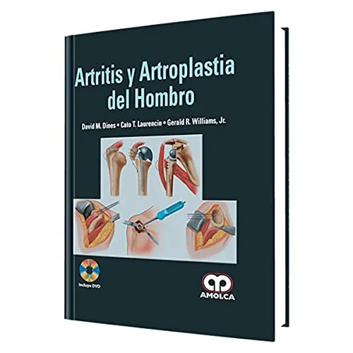 Portada de Artritis y Artrosplastia del Hombro