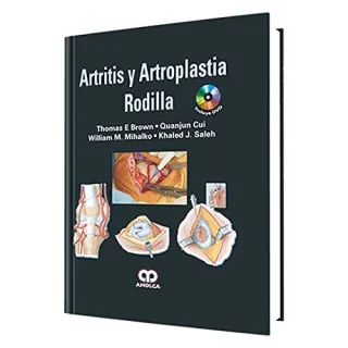 Portada de Artritis y artroplastia de rodilla