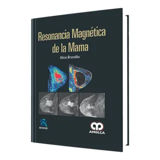 Portada de Resonancia magnética de la mama