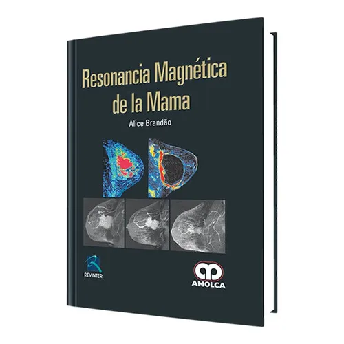 Portada de Resonancia magnética de la mama