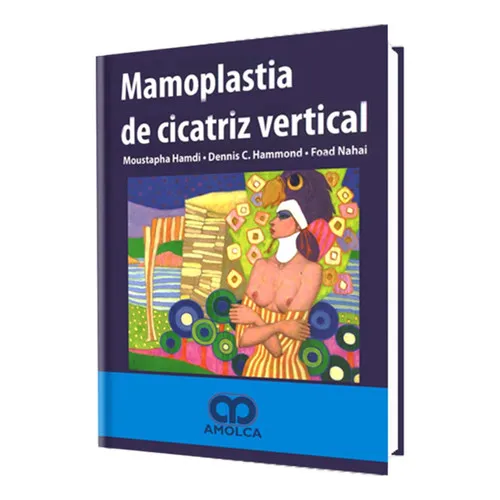 Portada de Mamoplastia de cicatriz vertical