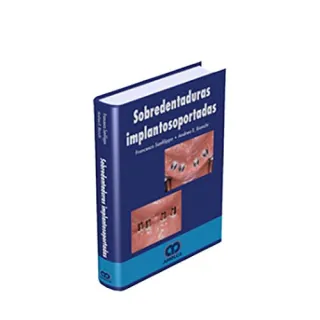 Portada de Sobredentaduras implantosoportadas