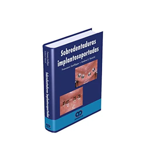 Portada de Sobredentaduras implantosoportadas