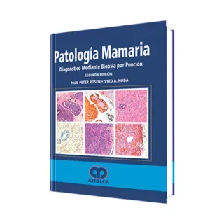 Portada de Patología mamaria - diagnóstico mediante biopsia por punción
