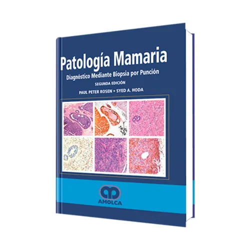 Portada de Patología mamaria - diagnóstico mediante biopsia por punción