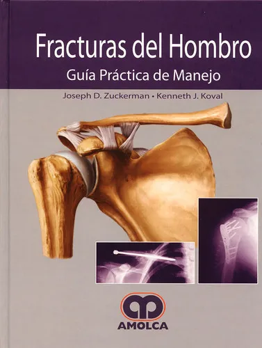Portada de Fracturas del Hombro