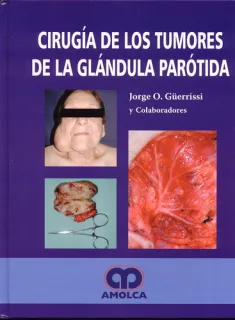 Portada de Cirugía de los tumores de la glándula parótida