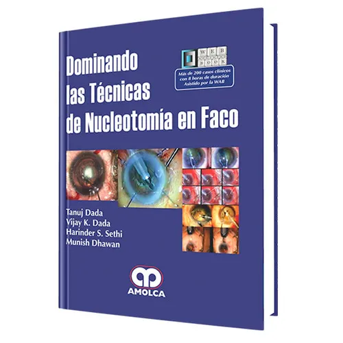 Portada de Dominando las técnicas de Nucleotomía en Faco