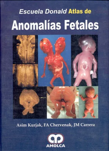 Portada de Atlas de anomalías fetales