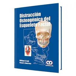Portada de Distracción osteogénica del esqueleto facial