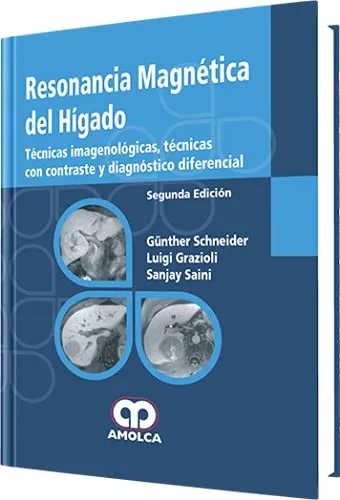 Portada de Resonancia magnética del hígado técnicas imagenológicas, técnicas con contraste y diagnóstico diferencial