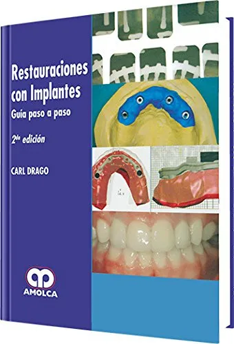 Portada de Restauraciones con implantes guía paso a paso