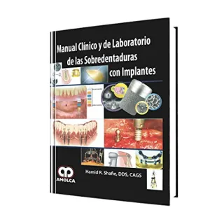 Portada de Manual clínico y de laboratorio de las sobredentaduras con implantes