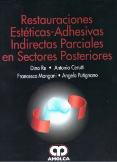 Portada de Restauraciones estéticas-adhesivas indirectas parciales en sectores posteriores