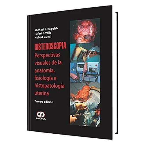 Portada de Histeroscopia perspectivas visuales sobre anatoma̕, fisiologa̕ e histopatologa̕ uterina