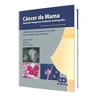 Portada de Cáncer de mama detección temprana mediante mamografía. Calcificaciones tipo piedra triturada : el tipo maligno más frecuente