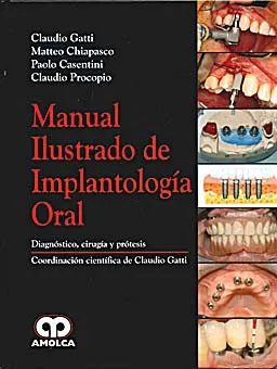 Portada de Manual ilustrado de implantología oral diagnóstico, cirugía y prótesis