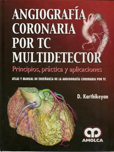 Portada de Angiografía coronaria por TC multidetector principios, práctica y aplicaciones. Atlas y manual de enseñanza de la angiografía coronaria por TC