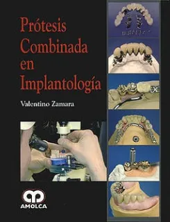 Portada de Prótesis combinada en implantología