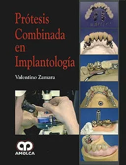 Portada de Prótesis combinada en implantología